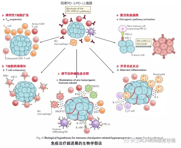 肝癌索拉非尼临床实验_肝癌的索拉非尼_肝癌的索拉菲尼