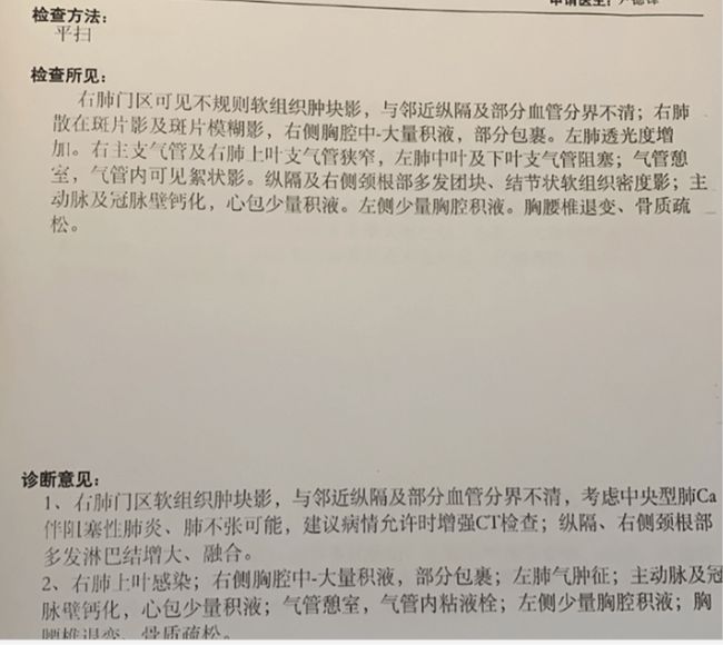 打了贝伐珠单抗癌胚抗原升高_贝伐珠单抗说明书_打贝伐珠单抗能不能停药