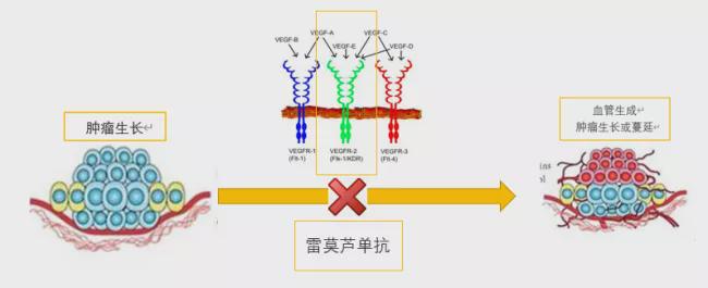 贝伐珠单抗价格_贝伐珠单抗排泄_贝伐珠单抗说明书