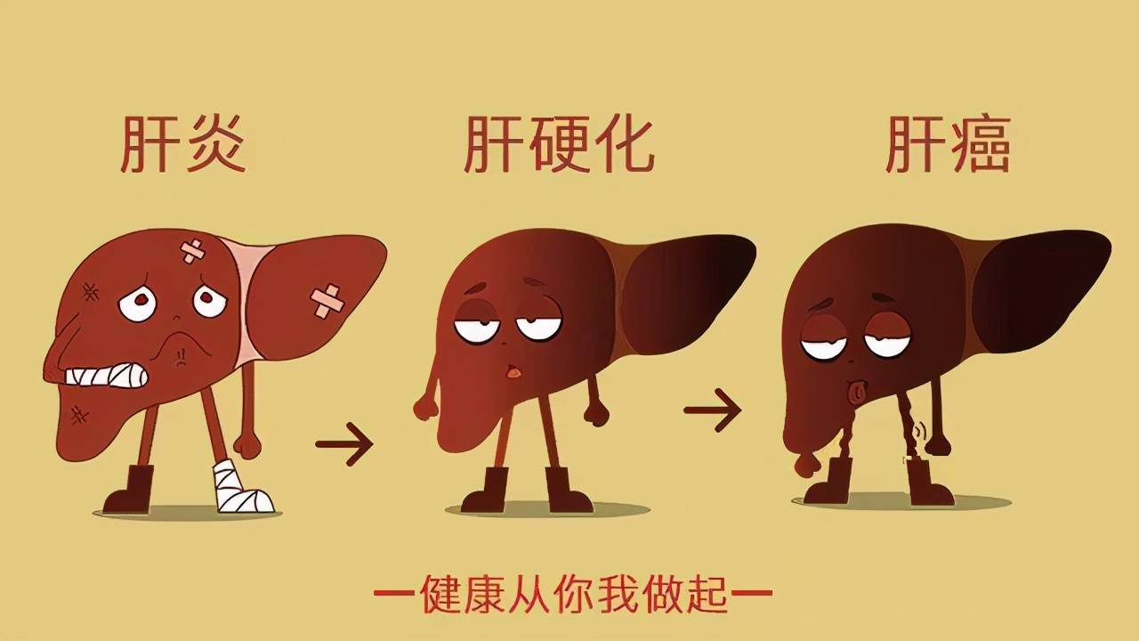 癌栓吃靶向药有用吗_肝静脉癌栓靶向药索拉非尼_什么叫肝动脉癌栓