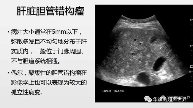 肝静脉癌栓靶向药索拉非尼_癌栓吃靶向药有用吗_索拉非尼的赠药政策