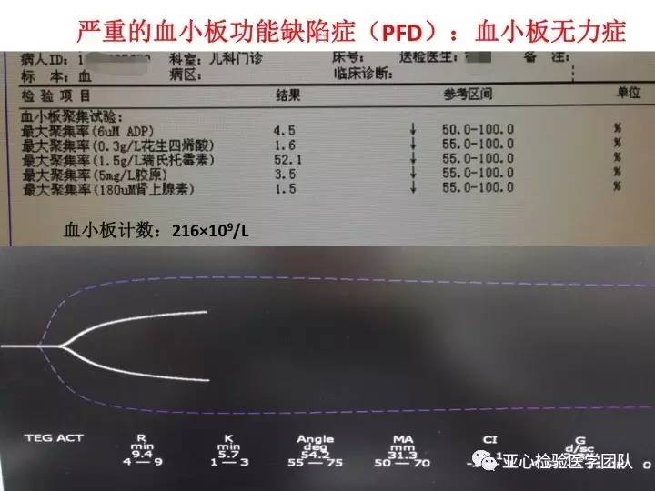 吉非替尼的副作用治疗_吉弗尼冻干粉_尼毕鲁ceo杨祥吉