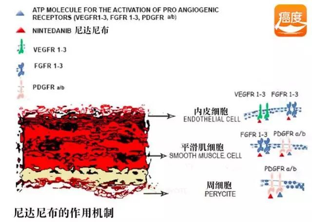 吉非替尼一般几个疗程_凡德他尼一个疗程_塞瑞替尼吃几个疗程