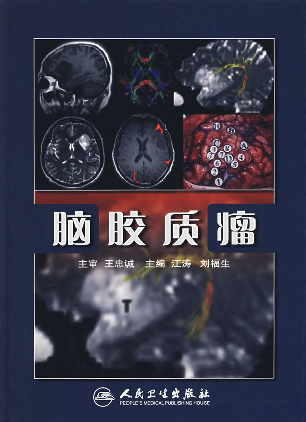 贝伐单抗是靶向药吗_贝伐单抗耐药性_贝伐单抗可以治疗脑水肿吗