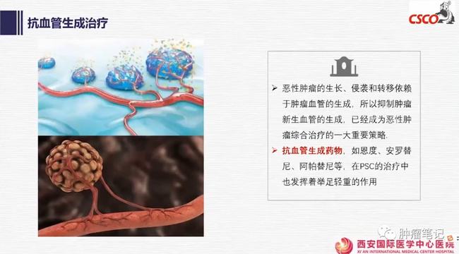 尼妥珠单抗联合化疗治疗胰腺癌的临床研究_贝伐单抗联合化疗治疗肺癌_贝伐珠单抗