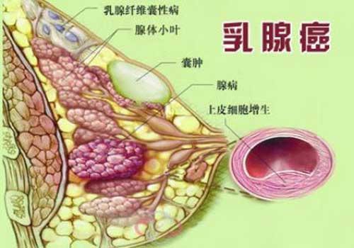 贝伐珠单抗社保给报嘛_贝伐珠单抗不良反应_贝伐珠单抗是化疗药吗