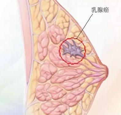 贝伐珠单抗不良反应_贝伐珠单抗是化疗药吗_贝伐珠单抗社保给报嘛