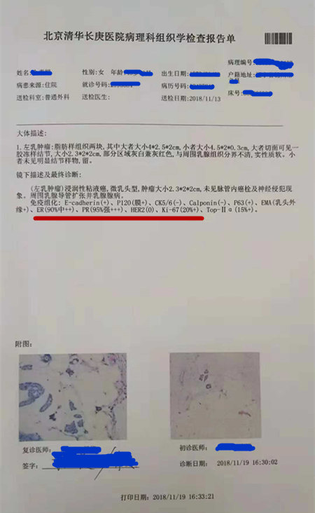 贝伐珠单抗 耐药性_贝伐珠单抗三阴乳腺癌用法用量_贝伐珠单抗不良反应