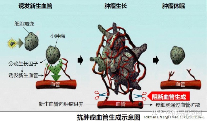 贝伐珠单抗是化疗吗_贝伐珠单抗是靶向药吗_贝伐珠单抗能彻底治疗癌症吗