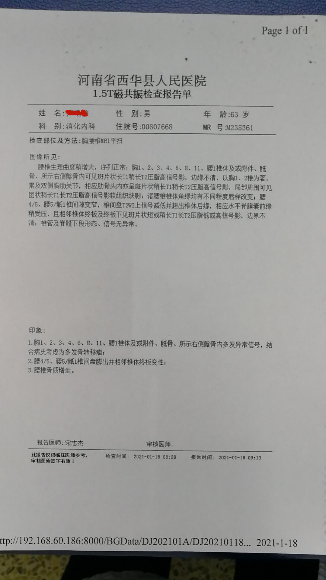 服用吉非替尼后骨转移怎么办_帕博西尼 服用几个疗程_导管原位癌没有转移需要服用三苯氧胺