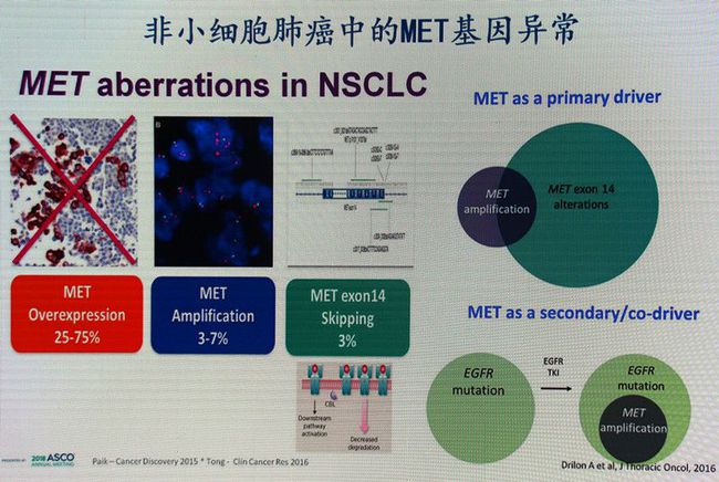 贝伐珠单抗4个月后赠药_贝伐珠单抗治疗肺腺癌_两次贝伐珠单抗胸水减少