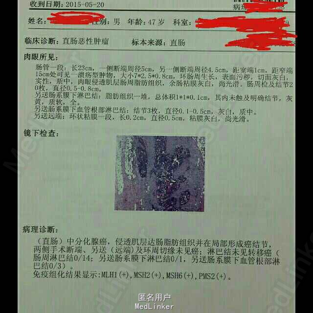 印度9291奥希替尼图片_奥希替尼对骨痛的效果_azd 9291 奥希替尼