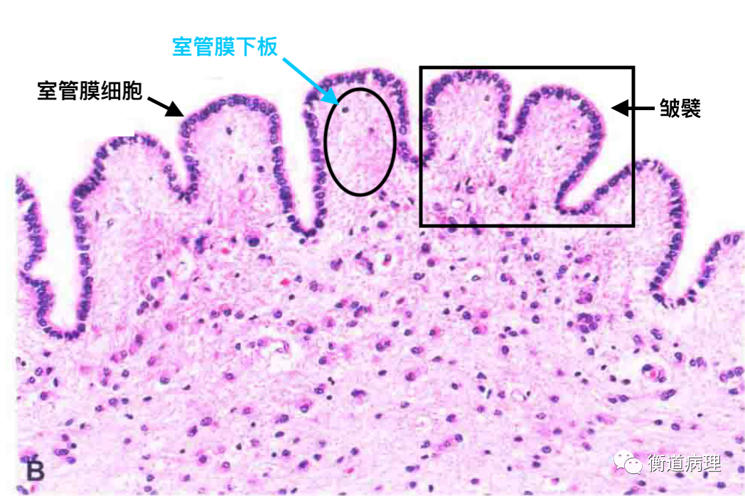 贝伐单抗是靶向药吗_胶质瘤四级术后贝伐单抗_贝伐珠单抗可以报销吗