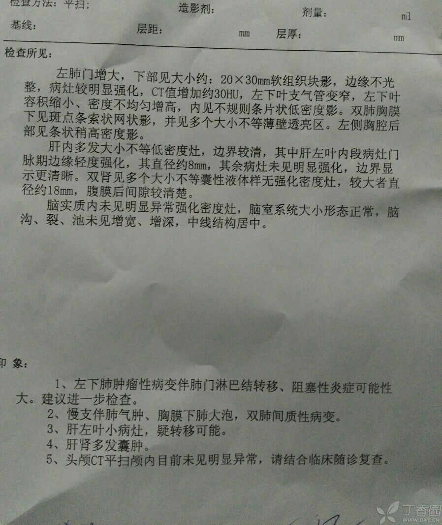 贝伐珠单抗价格_西妥昔单抗贝伐单抗_贝伐珠单抗连用方案