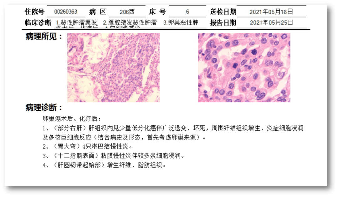 贝伐珠单抗是化疗吗_贝伐单抗是parp抑制剂吗_贝伐单抗印度版