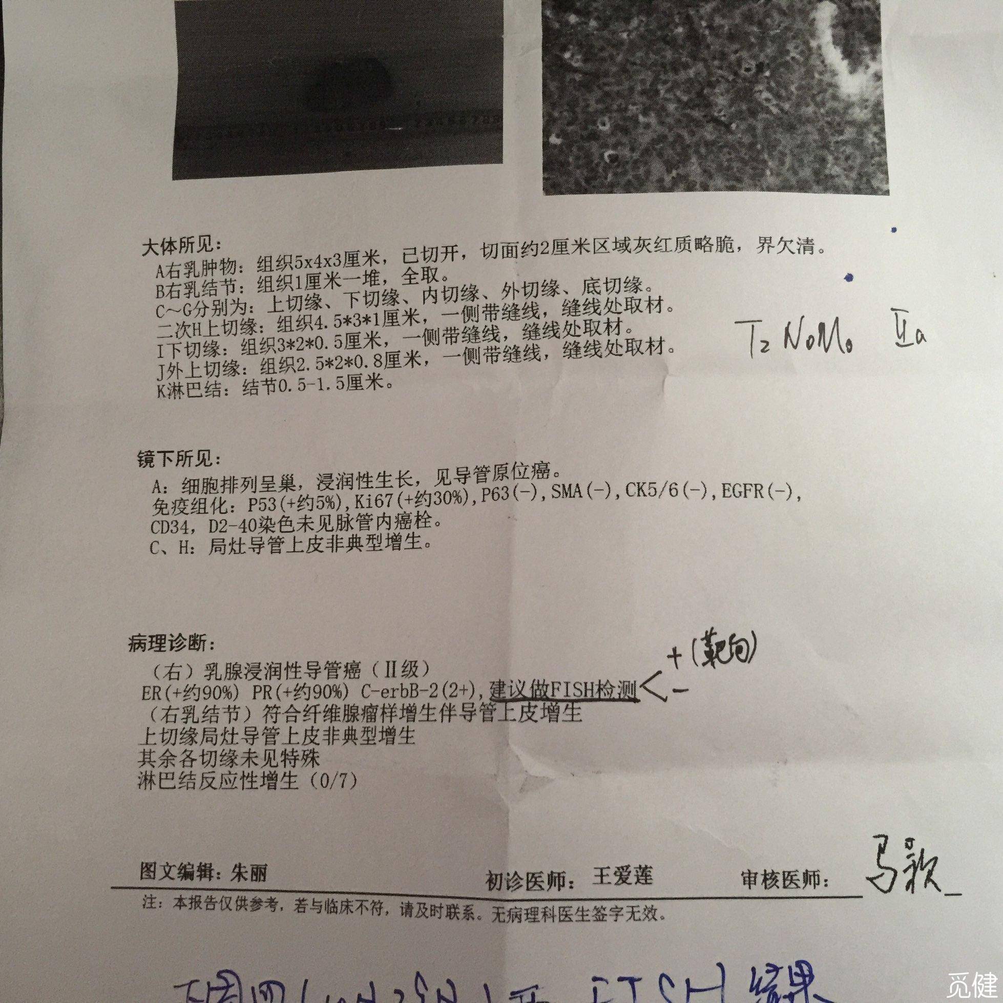 贝伐单抗和贝伐珠单抗_贝伐单抗是parp抑制剂吗_西妥昔单抗贝伐单抗