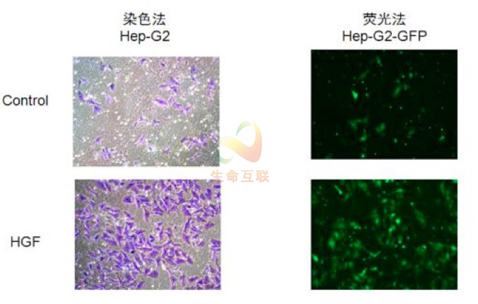 贝伐单抗什么时候纳入医保_贝伐珠单抗价格_贝伐珠单抗靶向是啥