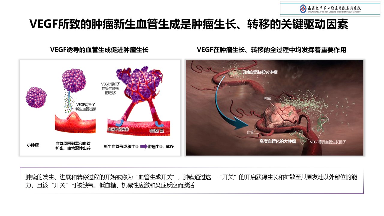 贝伐珠单抗是化疗药吗_贝伐珠单抗胸腔注射怎么配伍_贝伐珠单抗最新价格