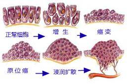 奥希替尼的疗效研究_去哪买印度版奥希替尼_奥希替尼印度版多少钱