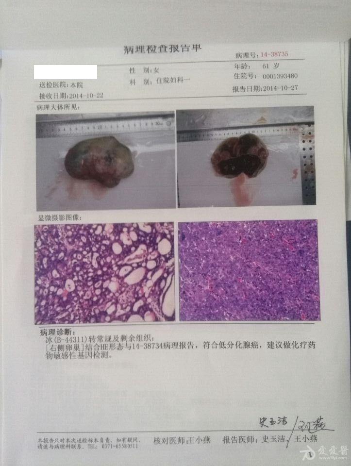 卵巢癌术后辅助应用贝伐单抗_贝伐珠单抗靶向是啥_贝伐单抗耐药后怎么办