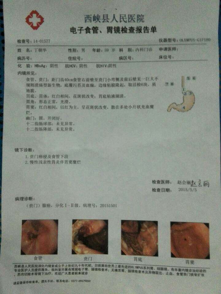 l858r突变奥希替尼疗效_香港买奥希替尼多少钱_21外显子l858r突变