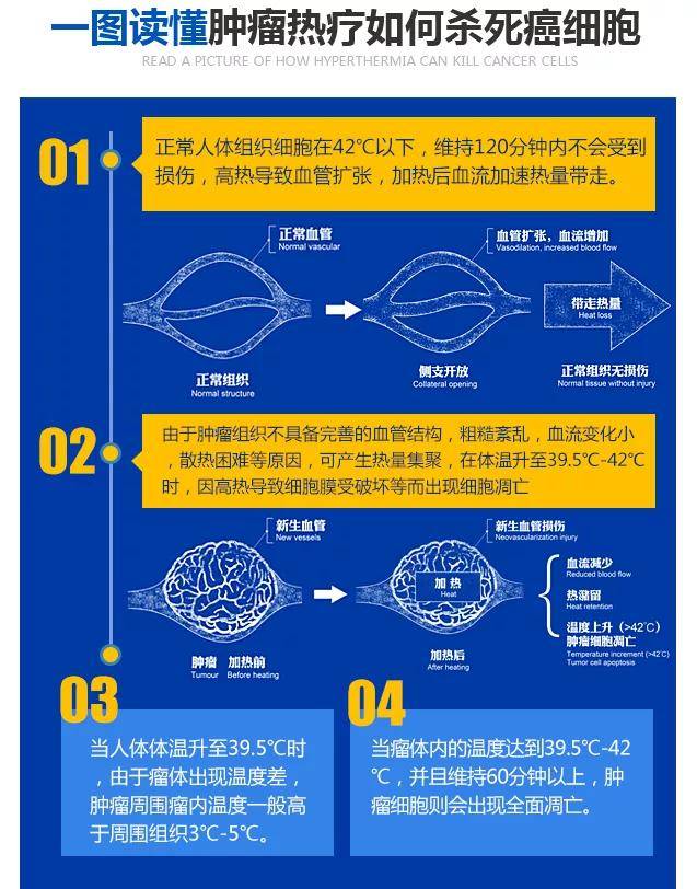 贝伐珠单抗是化疗药吗_贝伐珠单抗不良反应_贝伐珠单抗在卵巢癌能报医保么