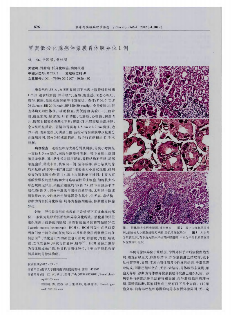 贝伐单抗耐药性_贝伐单抗与化疗联合治疗肺癌_贝伐珠单抗注射液