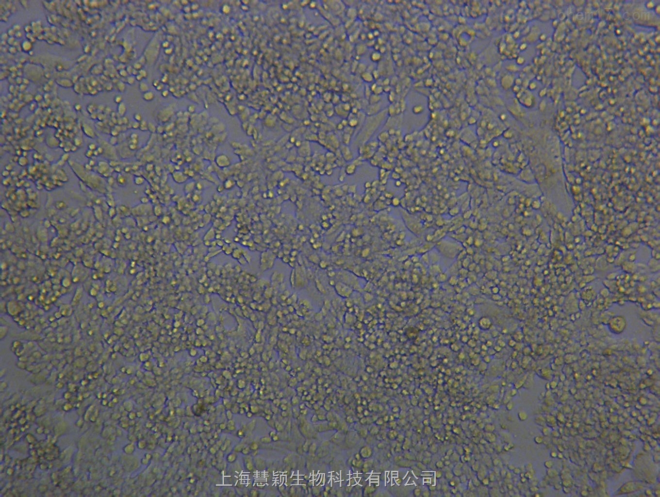 贝伐珠单抗4个月后赠药_贝伐珠单抗价格_贝伐珠单抗一只剂量