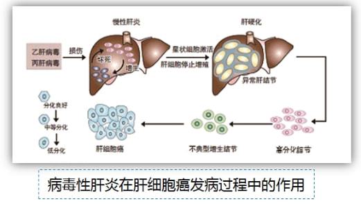 索拉非尼 舒尼替尼_细胞癌和癌有什么区别_肝细胞癌吃索拉非尼