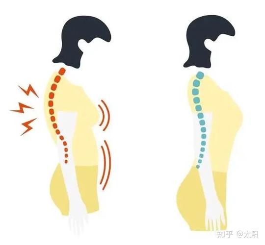 强直性脊柱炎能正常怀孕吗,强直性脊柱炎影响怀孕吗