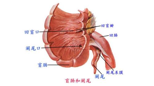 肠结核发病部位图片