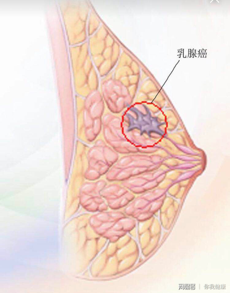 乳房长什么样图片